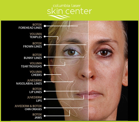 Total Transformations aesthetic treatments - available for Hood River, The Dalles and surrounding areas in Oregon and Washington at Columbia Laser Skin Center