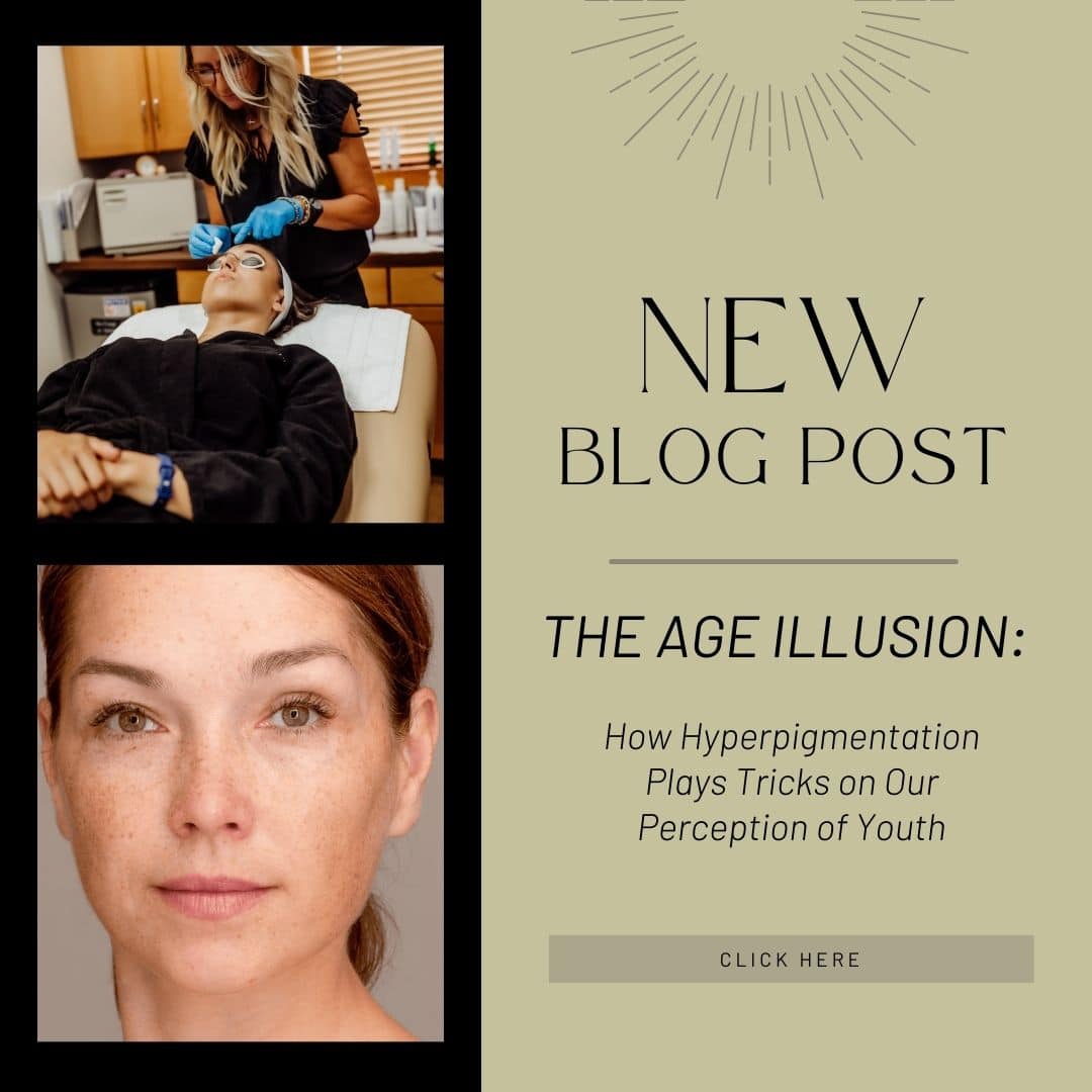 How Hyperpigmentation Plays Tricks on Our Perception of Youth